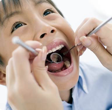 小児歯科 乳歯はまだエナメル質が不完全　だからこそ乳歯のむし歯予防が大切